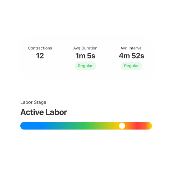 Contraction timeline showing labor pattern trends